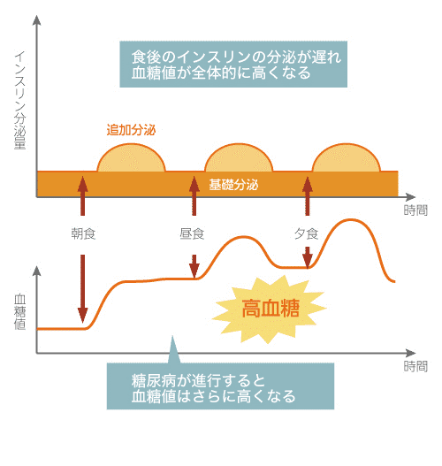 血糖値の一日の動きとインスリンの分泌