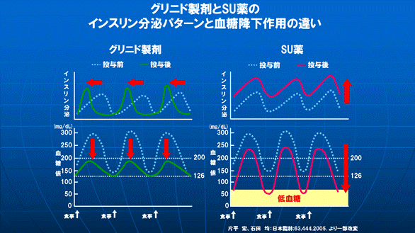 グリニド薬